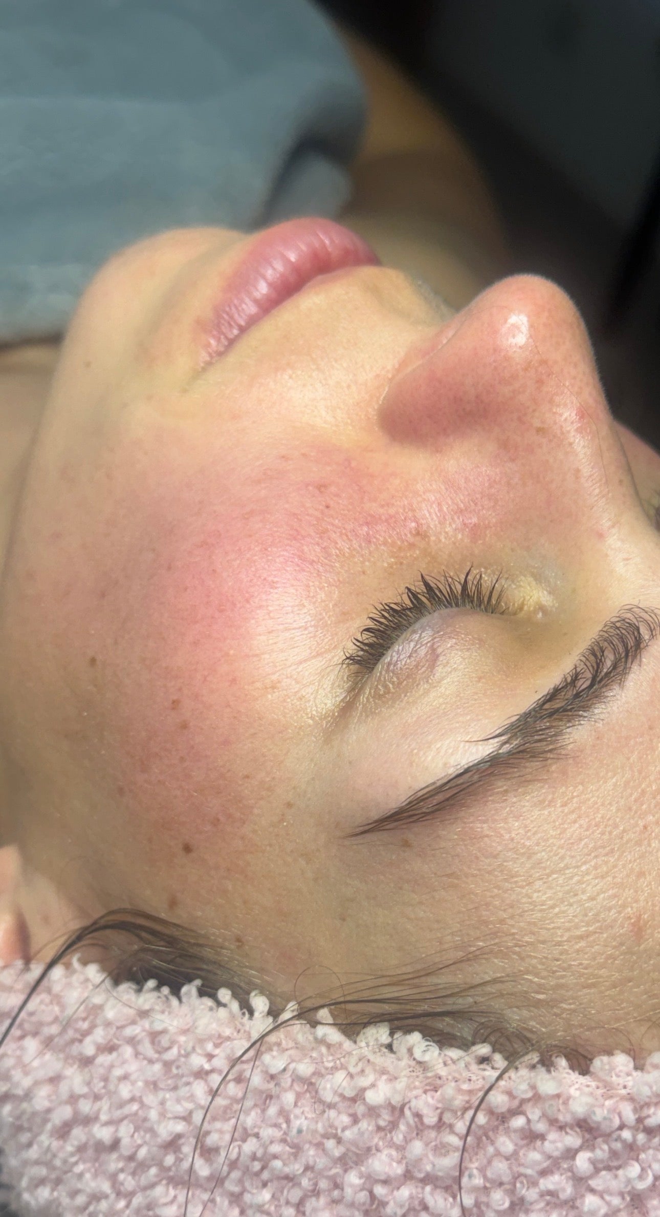 Comment bien nettoyer ma peau ? Mundo Image