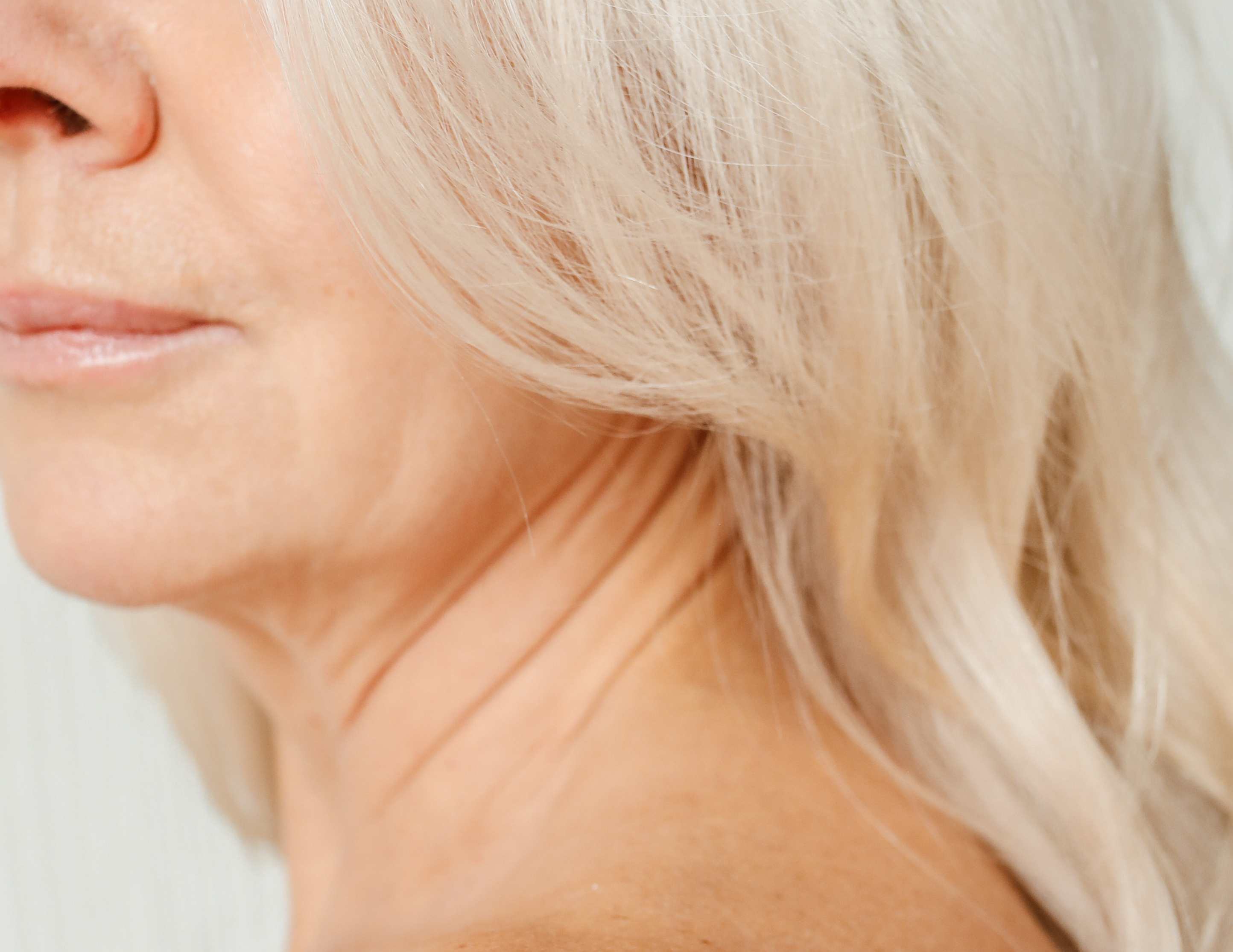 Image de la peau d'une femme de 50 ans présentant quelques rides, ridules et manque de fermeté. 